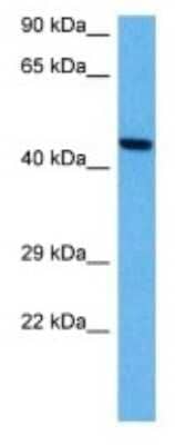 Western Blot: Somatostatin R3/SSTR3 Antibody [NBP3-10032] - Western blot analysis of Somatostatin R3/SSTR3 in Human Jurkat Whole Cell lysates. Antibody dilution at 1ug/ml