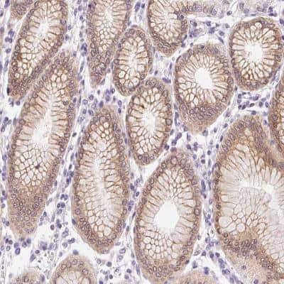 Immunohistochemistry-Paraffin Somatostatin R4/SSTR4 Antibody