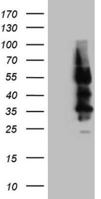 Western Blot: Somatostatin R4/SSTR4 Antibody (OTI2F11) - Azide and BSA Free [NBP2-74283] - Analysis of HEK293T cells were transfected with the pCMV6-ENTRY control (Left lane) or pCMV6-ENTRY SSTR4.