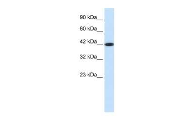 Western Blot: Somatostatin R4/SSTR4 Antibody [NBP2-88333] - WB Suggested Anti-SSTR4 Antibody Titration: 0.2-1 ug/ml. ELISA Titer: 1:62500. Positive Control: Jurkat cell lysate