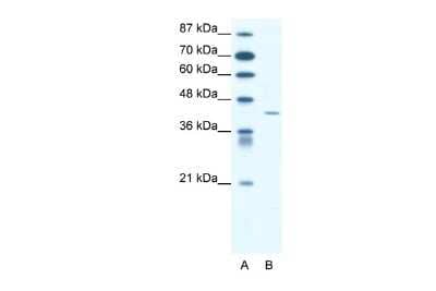 Western Blot: Somatostatin R4/SSTR4 Antibody [NBP2-88334] - WB Suggested Anti-SSTR4 Antibody. Titration: 1.25 ug/ml. Positive Control: Jurkat Whole Cell