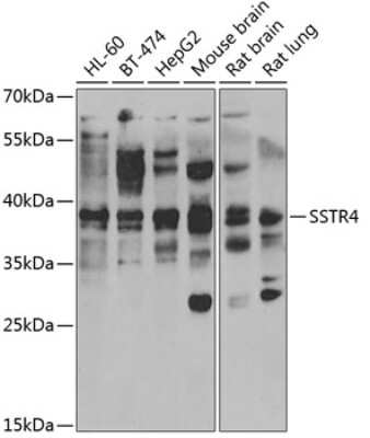 Western Blot: Somatostatin R4/SSTR4 Antibody [NBP2-95238] - Analysis of extracts of various cell lines, using Somatostatin R4/SSTR4 . Exposure time: 300s.