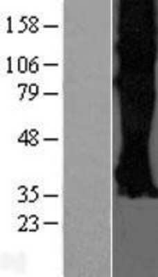 Western Blot Somatostatin R3/SSTR3 Overexpression Lysate