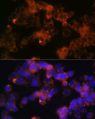 Immunocytochemistry/Immunofluorescence: Sonic Hedgehog/Shh Antibody (8T4D3) [NBP3-15454] - Immunofluorescence analysis of Hep G2 cells using Sonic Hedgehog/Shh (Shh) Rabbit mAb (NBP3-15454) at dilution of 1:100 (40x lens). Blue: DAPI for nuclear staining.