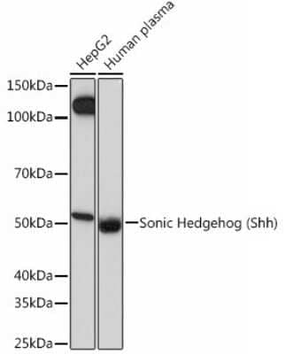 Western Blot: Sonic Hedgehog/Shh Antibody (8T4D3) [NBP3-15454] - Analysis of extracts of various cell lines, using Sonic Hedgehog/Shh (Shh) Rabbit mAb (NBP3-15454) at 1:1000 dilution. Secondary antibody: HRP Goat Anti-Rabbit IgG (H+L) at 1:10000 dilution. Lysates/proteins: 25ug per lane. Blocking buffer: 3% nonfat dry milk in TBST. Detection: ECL Basic Kit. Exposure time: 60s.