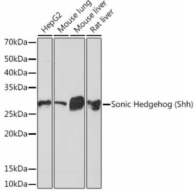 Western Blot: Sonic Hedgehog/Shh Antibody (8T4D3) [NBP3-15454] - Analysis of extracts of various cell lines, using Sonic Hedgehog/Shh (Shh) Rabbit mAb (NBP3-15454) at 1:1000 dilution. Secondary antibody: HRP Goat Anti-Rabbit IgG (H+L) at 1:10000 dilution. Lysates/proteins: 25ug per lane. Blocking buffer: 3% nonfat dry milk in TBST. Detection: ECL Basic Kit. Exposure time: 10s.