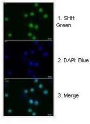 Immunohistochemistry: Sonic Hedgehog/Shh Antibody [NBP1-69270] - Human glioma cells. Primary Antibody Dilution :1:200  Secondary Antibody :Anti-rabbit-GFP. Secondary Antibody Dilution :1:500. Color/Signal Descriptions :1. SHH: Green 2. DAPI: Blue 3. Merge. Gene Name :SHH