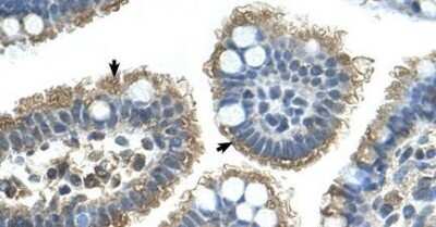 Immunohistochemistry-Paraffin: Sonic Hedgehog/Shh Antibody [NBP1-69270] - Human Intestine cells with positive label: Epithelial cells of intestinal villus (indicated with arrows).  Concentration 4.0-8.0 ug/ml