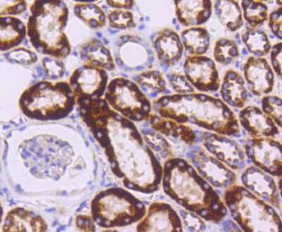 Immunohistochemistry-Paraffin: Sonic Hedgehog/Shh Antibody (SC05-28) [NBP2-67603] - Analysis of paraffin-embedded human kidney tissue using anti-Sonic Hedgehog Protein antibody. Counter stained with hematoxylin.