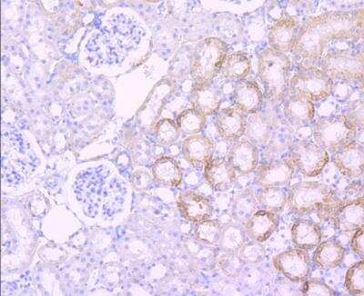 Immunohistochemistry-Paraffin: Sonic Hedgehog/Shh Antibody (SC05-28) [NBP2-67603] - Analysis of paraffin-embedded rat liver tissue using anti-Sonic Hedgehog Protein antibody. Counter stained with hematoxylin.
