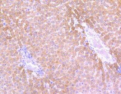 Immunohistochemistry-Paraffin: Sonic Hedgehog/Shh Antibody (SC05-28) [NBP2-67603] - Analysis of paraffin-embedded rat liver tissue using anti-Sonic Hedgehog Protein antibody. Counter stained with hematoxylin.