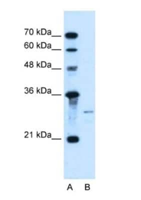 Western Blot: Sonic Hedgehog/Shh Antibody [NBP1-69270] - Lane A: Marker; Lane B HepG2 Cell Lysate.  Antibody titration 1.0ug/ml.  Gel concentration 12%