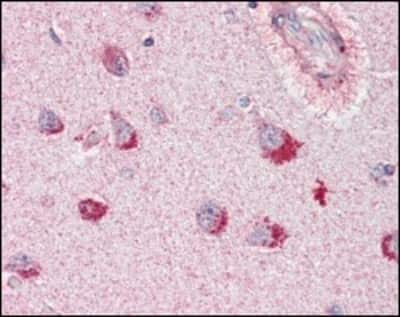 Immunohistochemistry-Paraffin: SorLA Antibody (3B6B11) [NBP1-28882] - Analysis of human brain, cortex tissues using SORL1 mouse mAb.