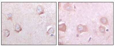 Immunohistochemistry-Paraffin: SorLA Antibody (3B6B11) [NBP1-28882] - Analysis of human cerebrum tissues using SORL1 mouse mAb with DAB staining.