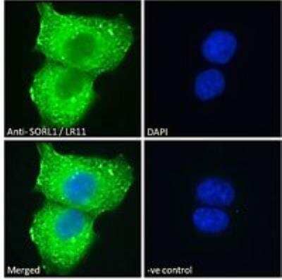 Immunofluorescence: SorLA Antibody [NB100-785] - Analysis of paraformaldehyde fixed A431 cells, permeabilized with 0.15% Triton. Primary incubation 1hr (10 ug/mL) followed by Alexa Fluor 488 secondary antibody (2 ug/mL), showing cytoplasmic with endosome staining. The nuclear stain is DAPI (blue). Negative control: Unimmunized goat IgG (10 ug/mL) followed by Alexa Fluor 488 secondary antibody (2 ug/mL).