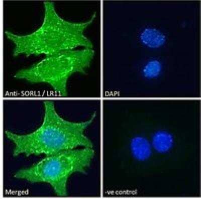 Immunofluorescence: SorLA Antibody [NB100-785] - Analysis of paraformaldehyde fixed HepG2 cells, permeabilized with 0.15% Triton. Primary incubation 1hr (10 ug/mL) followed by Alexa Fluor 488 secondary antibody (2 ug/mL), showing cytoplasmic/endosome, membrane and nuclear staining. The nuclear stain is DAPI (blue). Negative control: Unimmunized goat IgG (10 ug/mL) followed by Alexa Fluor 488 secondary antibody (2 ug/mL).