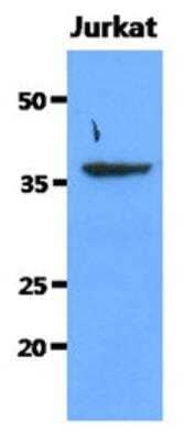 Western Blot: Sorbitol Dehydrogenase Antibody (10F4) [NBP2-42653] - The cell lysates of Jurkat (40ug) were resolved by SDS-PAGE, transferred to PVDF membrane and probed with anti-human Sorbitol Dehydrogenase antibody (1:1000). Proteins were visualized using a goat anti-mouse secondary antibody conjugated to HRP and an ECL detection system.