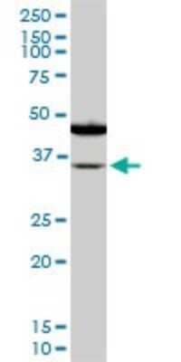 Western Blot: Sorbitol Dehydrogenase Antibody (4D3) [H00006652-M01] - SORD monoclonal antibody (M01), clone 4D3. Analysis of SORD expression in PC-12.