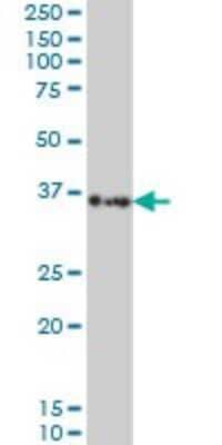 Western Blot: Sorbitol Dehydrogenase Antibody (4D3) [H00006652-M01] - SORD monoclonal antibody (M01), clone 4D3 Analysis of SORD expression in Hela S3 NE.
