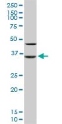 Western Blot: Sorbitol Dehydrogenase Antibody (4D3) [H00006652-M01] - SORD monoclonal antibody (M01), clone 4D3. Analysis of SORD expression in Raw 264.7.