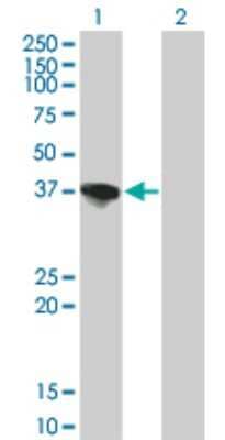 Western Blot: Sorbitol Dehydrogenase Antibody (4D3) [H00006652-M01] - Analysis of SORD expression in transfected 293T cell line by SORD monoclonal antibody (M01), clone 4D3.Lane 1: SORD transfected lysate(38.165 KDa).Lane 2: Non-transfected lysate.