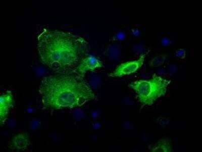 Immunocytochemistry/Immunofluorescence: Sorbitol Dehydrogenase Antibody (OTI9E7) [NBP2-02126] - Staining of COS7 cells transiently transfected by pCMV6-ENTRY Sorbitol Dehydrogenase.