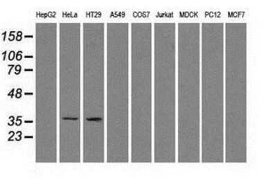 Western Blot: Sorbitol Dehydrogenase Antibody (9E7) [NBP2-02126] Analysis of extracts (35ug) from 9 different cell lines by using anti-Sorbitol Dehydrogenase monoclonal antibody.