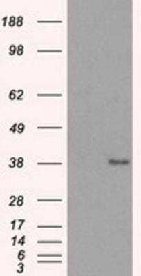 Western Blot: Sorbitol Dehydrogenase Antibody (9E7) [NBP2-02126] - HEK293T cells were transfected with the pCMV6-ENTRY control (Left lane) or pCMV6-ENTRY Sorbitol Dehydrogenase (Right lane) cDNA for 48 hrs and lysed. Equivalent amounts of cell lysates (5 ug per lane) were separated by SDS-PAGE and immunoblotted with anti-Sorbitol Dehydrogenase.