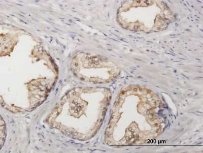 Immunohistochemistry-Paraffin: Sorbitol Dehydrogenase Antibody [H00006652-B01P] - Analysis of purified antibody to SORD on formalin-fixed paraffin-embedded human prostate. (antibody concentration 3 ug/ml)