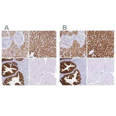 <b>Independent Antibodies Validation and Orthogonal Strategies Validation.</b>Immunohistochemistry-Paraffin: Sorbitol Dehydrogenase Antibody [NBP1-87415] - Staining of human kidney, liver, prostate and skeletal muscle using Anti-SORD antibody NBP1-87415 (A) shows similar protein distribution across tissues to independent antibody NBP1-87416 (B).