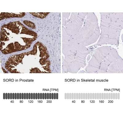 Immunohistochemistry-Paraffin: Sorbitol Dehydrogenase Antibody [NBP1-87415] - Analysis in human prostate and skeletal muscle tissues using NBP1-87415 antibody. Corresponding SORD RNA-seq data are presented for the same tissues.