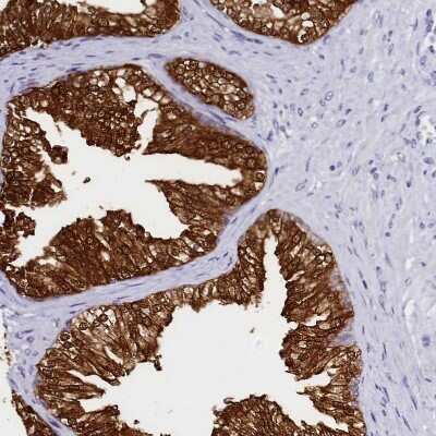 Immunohistochemistry-Paraffin: Sorbitol Dehydrogenase Antibody [NBP1-87415] - Staining of human prostate shows strong cytoplasmic positivity in glandular cells.