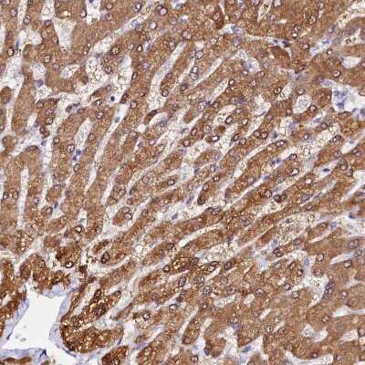 Immunohistochemistry-Paraffin: Sorbitol Dehydrogenase Antibody [NBP1-87415] - Staining of human liver shows strong cytoplasmic positivity in hepatocytes.