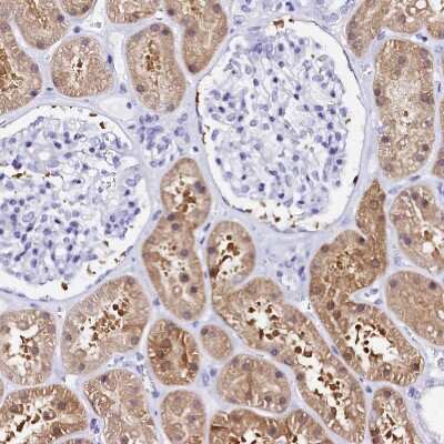 Immunohistochemistry-Paraffin: Sorbitol Dehydrogenase Antibody [NBP1-87415] - Staining of human kidney shows moderate cytoplasmic positivity in cells in tubules.