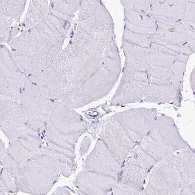 Immunohistochemistry-Paraffin: Sorbitol Dehydrogenase Antibody [NBP1-87415] - Staining of human skeletal muscle shows no positivity in myocytes as expected.