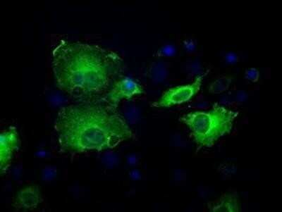 Immunocytochemistry/Immunofluorescence: Sorbitol Dehydrogenase Antibody (OTI9E7) - Azide and BSA Free [NBP2-74288] - Staining of COS7 cells transiently transfected by pCMV6-ENTRY Sorbitol Dehydrogenase.