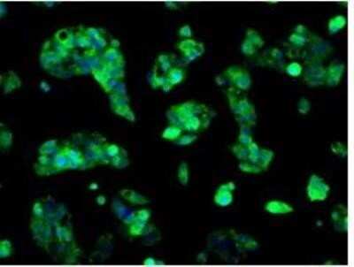 Immunocytochemistry/Immunofluorescence: Sorbitol Dehydrogenase Antibody (OTI9E7) - Azide and BSA Free [NBP2-74288] - Staining of HepG2 cells using anti-SORD mouse monoclonal antibody.