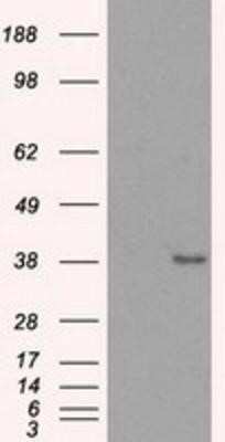 Western Blot: Sorbitol Dehydrogenase Antibody (OTI9E7) - Azide and BSA Free [NBP2-74288] - HEK293T cells were transfected with the pCMV6-ENTRY control (Left lane) or pCMV6-ENTRY Sorbitol Dehydrogenase (Right lane) cDNA for 48 hrs and lysed. Equivalent amounts of cell lysates (5 ug per lane) were separated by SDS-PAGE and immunoblotted with anti