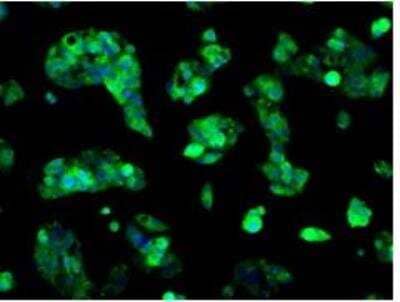 Immunocytochemistry/Immunofluorescence: Sorbitol Dehydrogenase Antibody (OTI9E7) [NBP2-02126] - Staining of HepG2 cells using anti-SORD mouse monoclonal antibody.