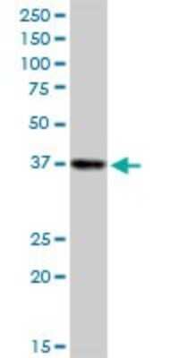 Western Blot: Sorbitol Dehydrogenase Antibody [H00006652-B01P] - Analysis of SORD expression in Jurkat.