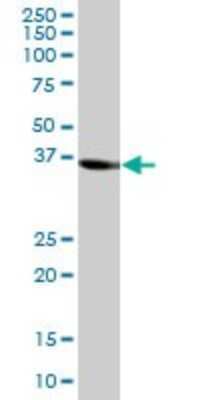 Western Blot: Sorbitol Dehydrogenase Antibody [H00006652-B01P] - Analysis of SORD expression in human liver.