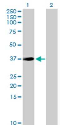 Western Blot: Sorbitol Dehydrogenase Antibody [H00006652-D01P] - Analysis of SORD expression in transfected 293T cell line by SORD polyclonal antibody.Lane 1: SORD transfected lysate(38.30 KDa).Lane 2: Non-transfected lysate.