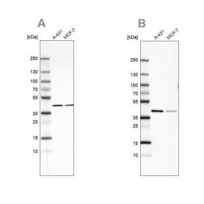 <b>Independent Antibodies Validation. </b>Western Blot: Sorbitol Dehydrogenase Antibody [NBP1-87415] - Analysis using Anti-SORD antibody NBP1-87415 (A) shows similar pattern to independent antibody NBP1-87416 (B).