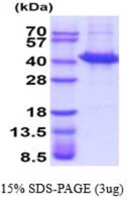 SDS-Page: Sorbitol Dehydrogenase Recombinant Protein [NBP2-52293] - 15% SDS Page (3 ug)