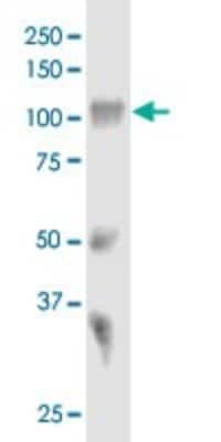 Western Blot: Sortilin Antibody (1B3) [H00006272-M01] - SORT1 monoclonal antibody (M01), clone 1B3. Analysis of SORT1 expression in human placenta.