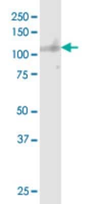 Western Blot: Sortilin Antibody (1B3) [H00006272-M01] - SORT1 monoclonal antibody (M01), clone 1B3. Analysis of SORT1 expression in rat brain.