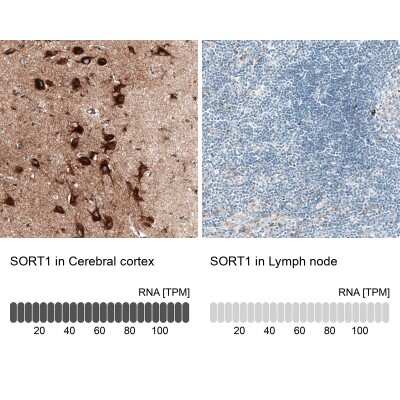 Immunohistochemistry-Paraffin: Sortilin Antibody (CL6526) [NBP2-76498] - Analysis in human cerebral cortex and lymph node tissues. Corresponding SORT1 RNA-seq data are presented for the same tissues.