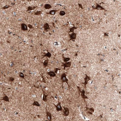 Immunohistochemistry-Paraffin: Sortilin Antibody (CL6526) [NBP2-76498] - Staining of human cerebral cortex shows strong cytoplasmic positivity in neurons.