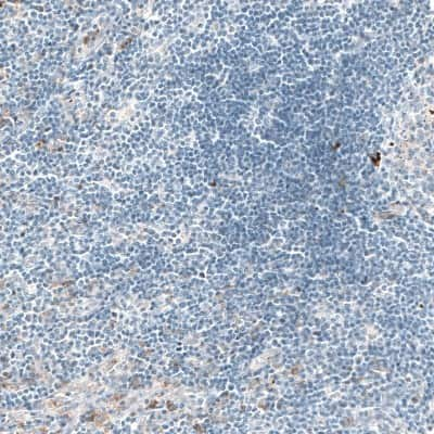 Immunohistochemistry-Paraffin: Sortilin Antibody (CL6526) [NBP2-76498] - Staining of human lymph node shows only weak positivity in a subset of lymphoid cells, as expected.