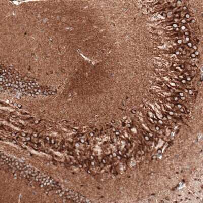 Immunohistochemistry-Paraffin: Sortilin Antibody (CL6526) [NBP2-76498] - Staining of mouse hippocampus shows strong cytoplasmic positivity in both pyramidal neurons and granular cells.